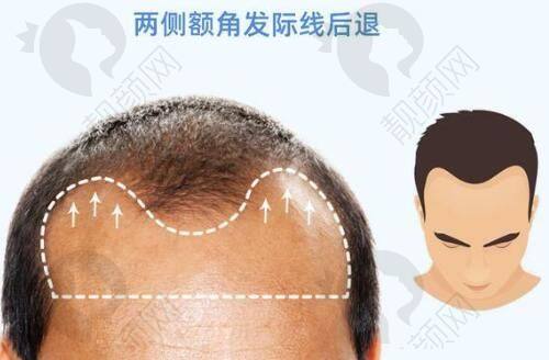 沈阳名流王松医生的真实的患者评价如下：