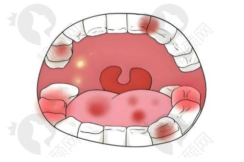 六、廊坊霸州中科口腔医院真实的患者评价如下：