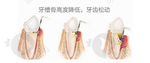 北京奥尔贝德谢宏彬医生做面部拉皮提升怎么样？