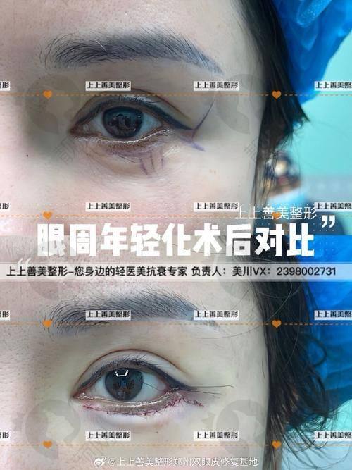 三、兰州时光激光医疗美容医院医生介绍: