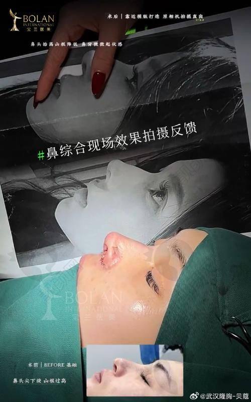五、兰州时光激光医疗美容医院怎么预约: