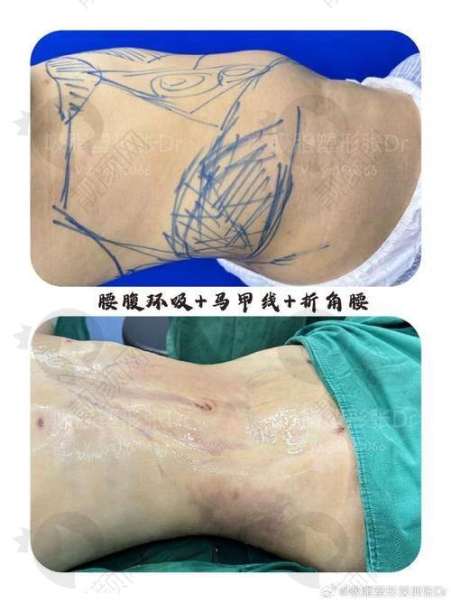 兰州时光激光整形美容医院逯岩医生做擅长项目怎么样?