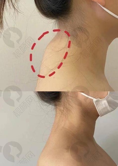 兰州韩美医疗美容：专注脂肪整形，服务贴心周到