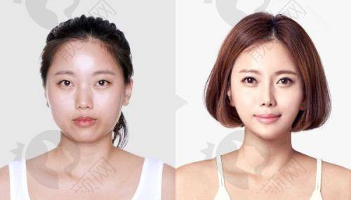 五、潍坊壹美天成医疗美容医院怎么预约：