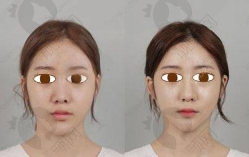 七、重庆军科疤痕中 心真实的患者评价如下:
