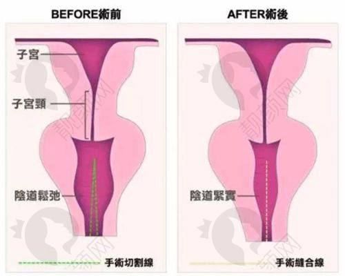 五、深圳军科医疗美容门诊部怎么预约：
