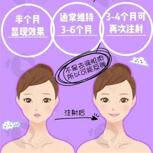 碧莲盛植发选择建议:如何挑选适合自己的套餐