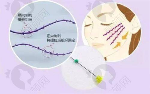 碧莲盛植发口碑见证:患者真实评价超靠谱