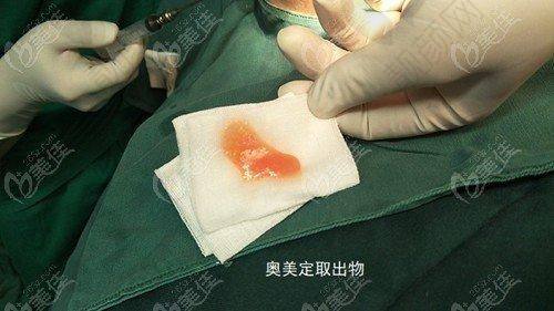 广州荔医齐云香医生擅长的项目怎么样？