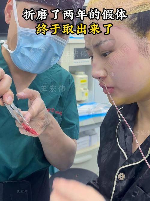 广州荔医齐云香医生的真实的患者评价如下：