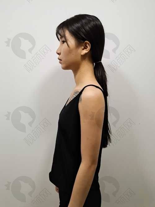 成都八大处唐勇医生隆胸和吸脂怎么样？