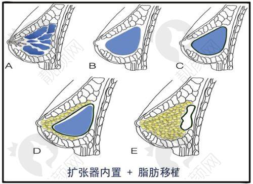成都八大处邱欣医生简介