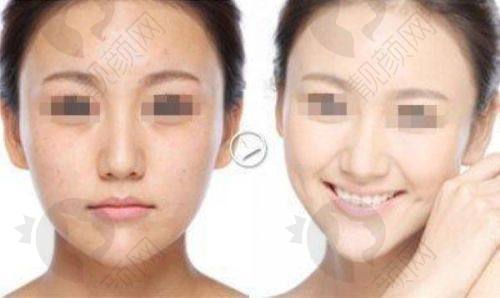 武汉天佑双眼皮怎么样?价格透明合理