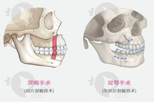 成都八大处邱欣医生的真实患者评价如下：