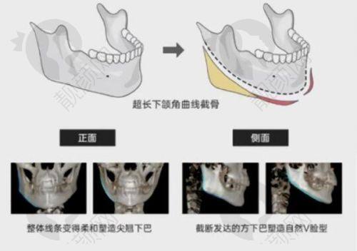 成都八大处侯典举医生简介