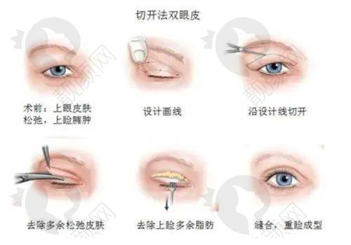 武汉天佑双眼皮怎么样?医生团队技术不错