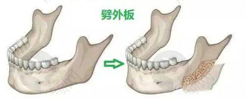 三、沈阳市第四人民医院整形外科医生介绍: