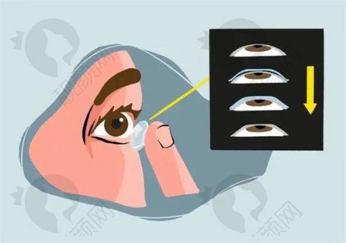七、玉林华厦眼科医院真实的患者评价如下: