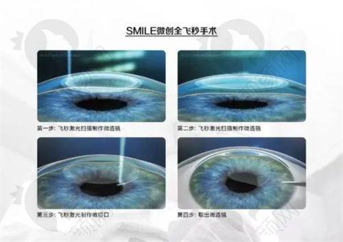 北京希玛林顺潮眼科医院技术精良,为患者带来福音