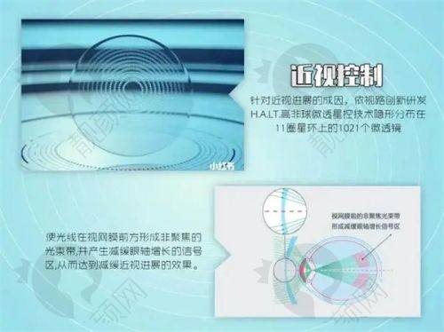 北京熙仁眼科医院眼疾诊疗实力强