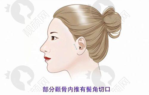 成都八大处侯典举医生的真实的患者评价如下：