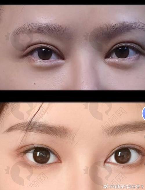 极高性价比的修复体验