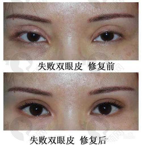 偶然遇见兰州时光逯岩医生