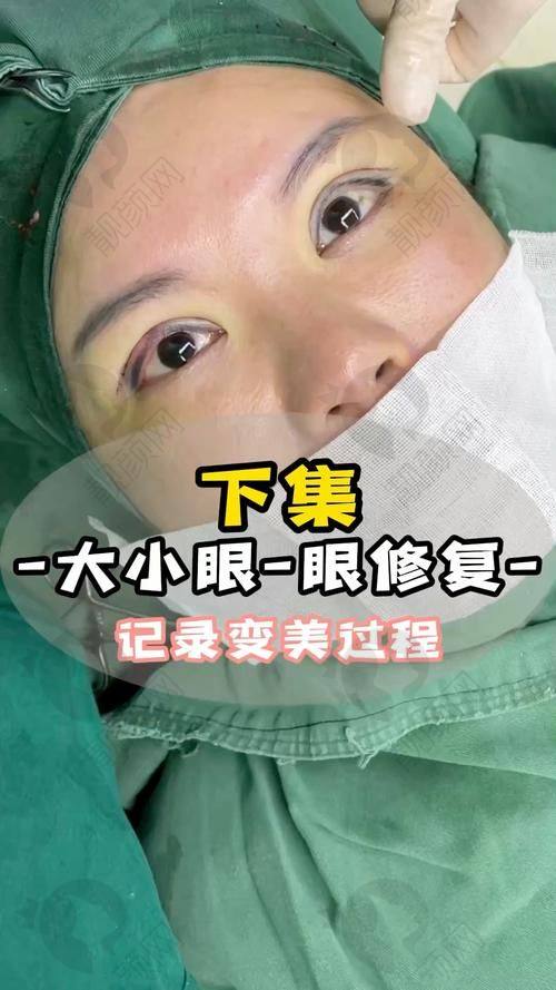 神奇的修复过程与成效