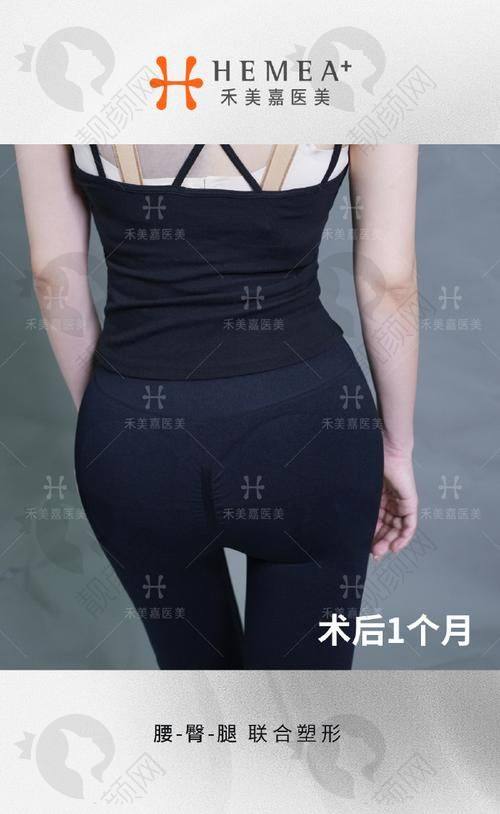 成都八大处陶俊医生擅长的项目怎么样？