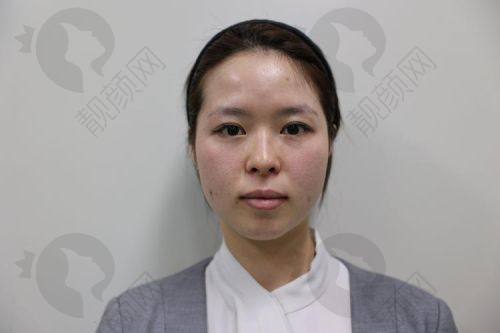 上海美莱申涛医生的真实的患者评价如下：