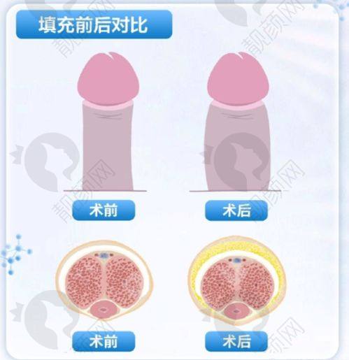 西安艺星医疗美容医院地址优越在哪？交通便利易到达