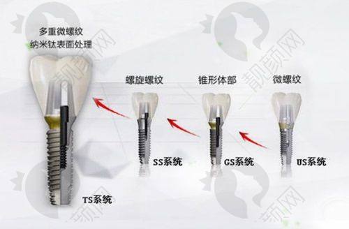 大连九诺口腔和康贝佳口腔哪个好?技术实力大比拼