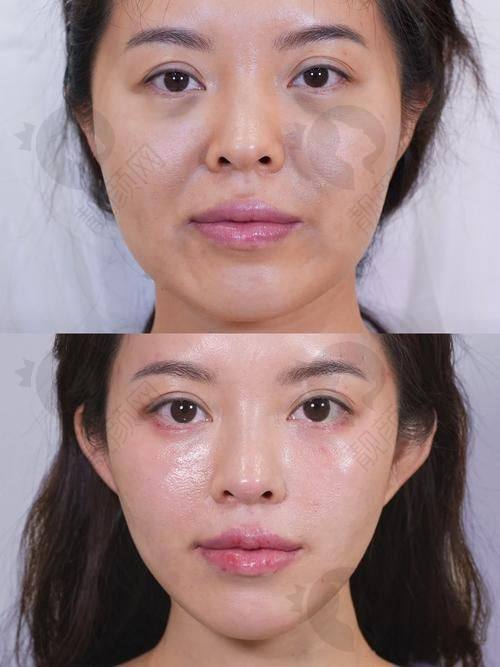修复后的惊人成效