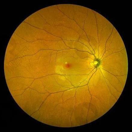 北京熙仁眼科医院：正规专精的眼科机构