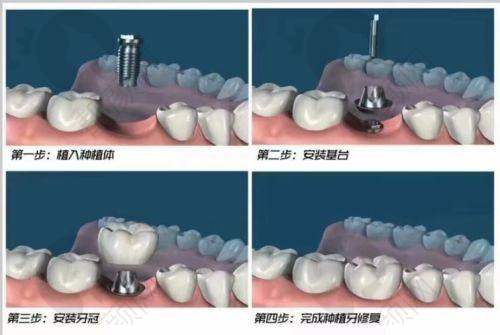 常熟明日口腔的优点总结
