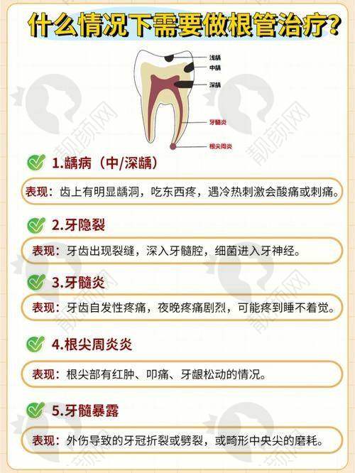 珠海海精灵口腔根管治疗的真实评价