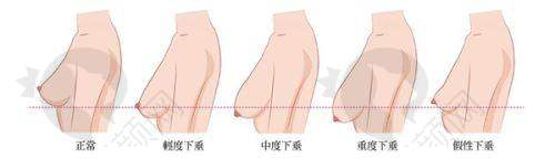注意事项