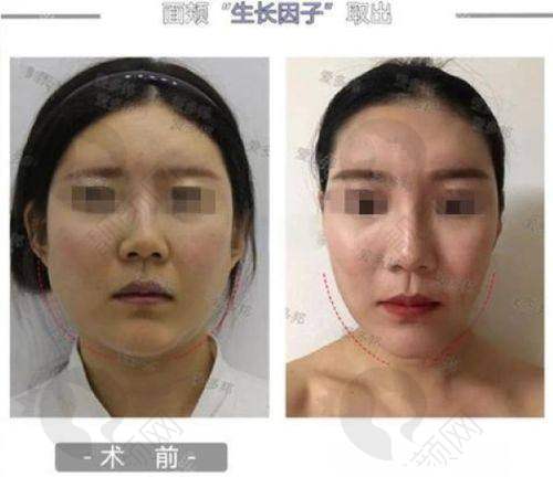 就诊建议