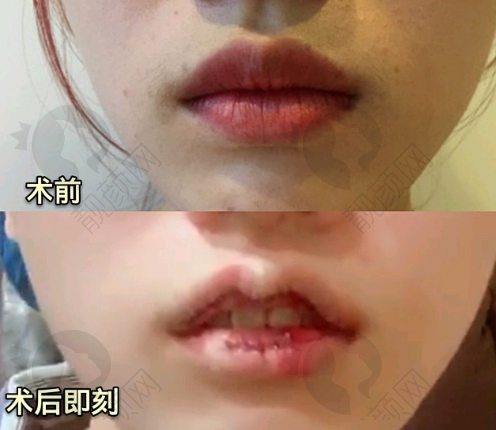 二、新疆喀什昕整医疗美容门诊部正规吗？来看看医院资质：