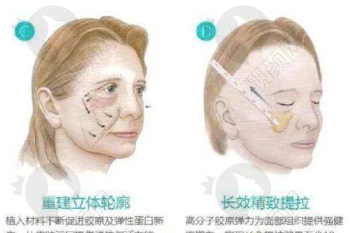 擅长项目