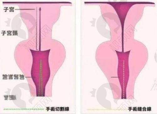 口腔美容项目