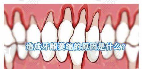 仁寿县看牙好的牙科医院名单在线揭秘:海豚等5家口碑佳,技术强值得信赖