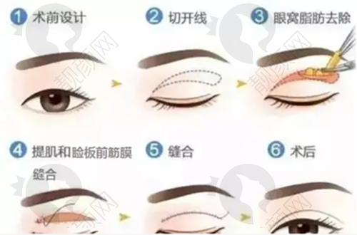 南昌市第十二医院植发科的优势