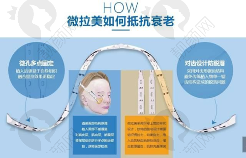 杭州薇琳医疗美容医院:服务优质,流程合规