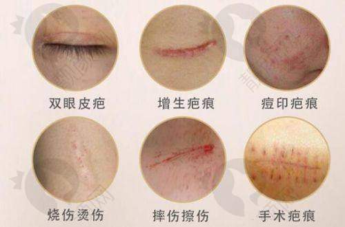 咸阳眼科医院综合对比