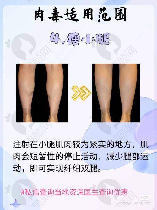 在六盘水整形医院中的地位