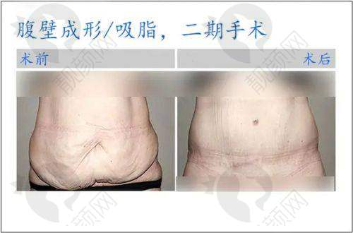 鹤壁美林苑整形门诊部是否靠谱