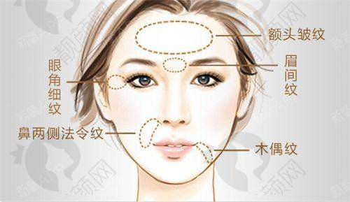 南京美莱整形医院除皱针项目真实评价