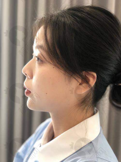 选专精医院，技术实力有保护