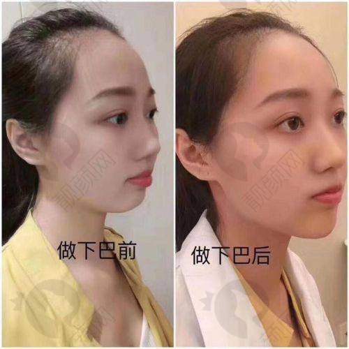 专精医院口碑好，患者满意度高